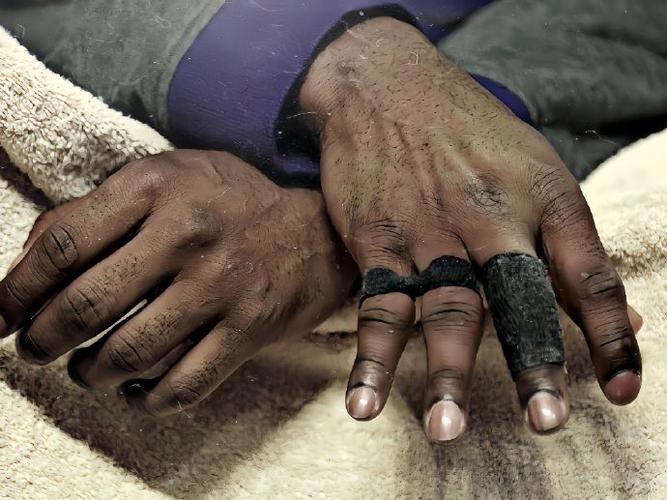 科比被烧成什么样了